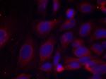 Phospho-NFkB p105 (Ser893) Antibody in Immunocytochemistry (ICC/IF)