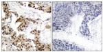 Phospho-NFkB p105 (Ser893) Antibody in Immunohistochemistry (Paraffin) (IHC (P))