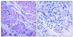 Phospho-PDPK1 (Ser241) Antibody in Immunohistochemistry (Paraffin) (IHC (P))