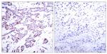 Phospho-STAT6 (Thr645) Antibody in Immunohistochemistry (Paraffin) (IHC (P))