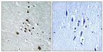 Phospho-SF1 (Ser82) Antibody in Immunohistochemistry (Paraffin) (IHC (P))