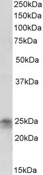 FGF8 Antibody in Western Blot (WB)