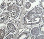 HOXA10 Antibody in Immunohistochemistry (Paraffin) (IHC (P))