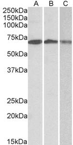 OAS2 Antibody in Western Blot (WB)