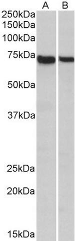 STXBP3 Antibody in Western Blot (WB)