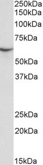 STXBP3 Antibody in Western Blot (WB)