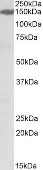 MAST3 Antibody in Western Blot (WB)