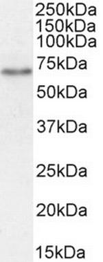 SGLT1 Antibody in Western Blot (WB)