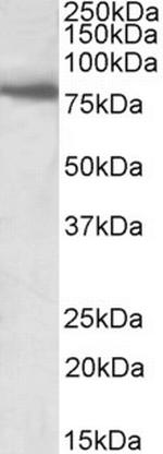 BBS7 Antibody in Western Blot (WB)