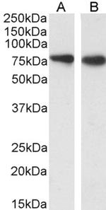 SLC26A6 Antibody in Western Blot (WB)