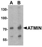 ATMIN Antibody in Western Blot (WB)