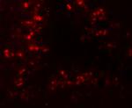 CRBN Antibody in Immunohistochemistry (Paraffin) (IHC (P))