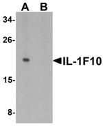 IL1F10 Antibody in Western Blot (WB)