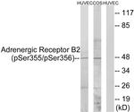 Phospho-beta-2 Adrenergic Receptor (Ser355, Ser356) Antibody in Western Blot (WB)