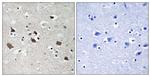 Phospho-SLP76 (Tyr128) Antibody in Immunohistochemistry (Paraffin) (IHC (P))