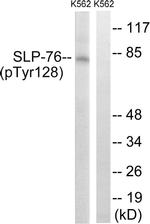 Phospho-SLP76 (Tyr128) Antibody in Western Blot (WB)