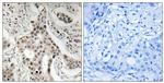 Phospho-SRC2 (Ser736) Antibody in Immunohistochemistry (Paraffin) (IHC (P))