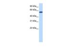 ZNF394 Antibody in Western Blot (WB)