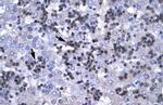 RBPJ Antibody in Immunohistochemistry (IHC)