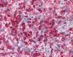 EAP30 Antibody in Immunohistochemistry (Paraffin) (IHC (P))