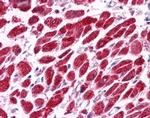 EAP30 Antibody in Immunohistochemistry (Paraffin) (IHC (P))