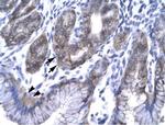 EAP30 Antibody in Immunohistochemistry (Paraffin) (IHC (P))