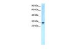 EAP30 Antibody in Western Blot (WB)