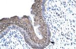 FOXE3 Antibody in Immunohistochemistry (IHC)