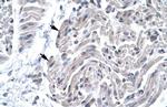 FOXE3 Antibody in Immunohistochemistry (IHC)