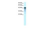 PLA1 Antibody in Western Blot (WB)