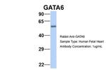 GATA6 Antibody in Western Blot (WB)