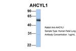 AdoHcyase 2 Antibody in Western Blot (WB)