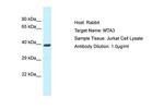 MTA3 Antibody in Western Blot (WB)