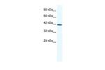 SOX11 Antibody in Western Blot (WB)