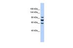 EPC1 Antibody in Western Blot (WB)