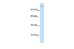 SPT5 Antibody in Western Blot (WB)