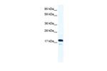 TAF9 Antibody in Western Blot (WB)