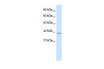 KCNIP4 Antibody in Western Blot (WB)