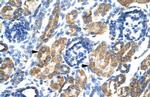 HSF2BP Antibody in Immunohistochemistry (IHC)