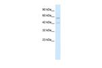 CHRNA5 Antibody in Western Blot (WB)