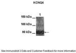 KCNQ4 Antibody in Western Blot (WB)