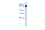 FUBP1 Antibody in Western Blot (WB)