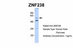 ZNF238 Antibody in Western Blot (WB)