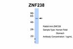 ZNF238 Antibody in Western Blot (WB)