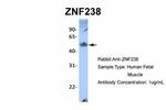 ZNF238 Antibody in Western Blot (WB)