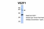 VEZF1 Antibody in Western Blot (WB)