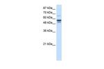 FOXG1 Antibody in Western Blot (WB)