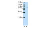 GRHL3 Antibody in Western Blot (WB)