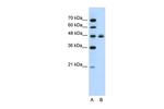 HSPBAP1 Antibody in Western Blot (WB)