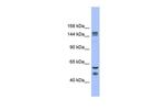 FBXL10 Antibody in Western Blot (WB)